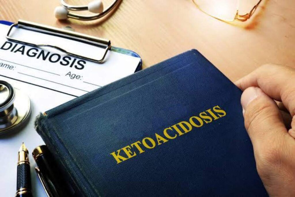 A picture of Diabetic Ketoacidosis diagnosis