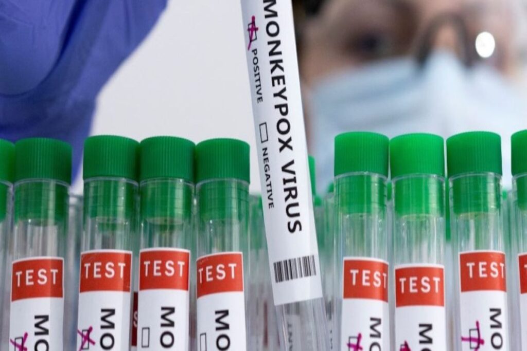 A Picture of Mpox Test Kits