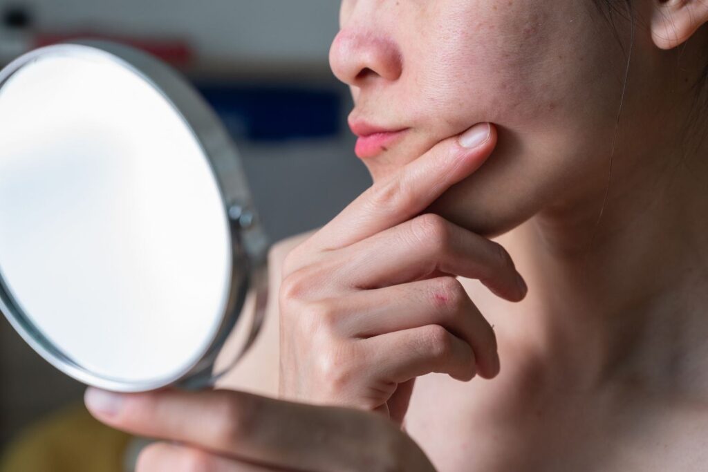 A picture of a lady checking her cortisol face